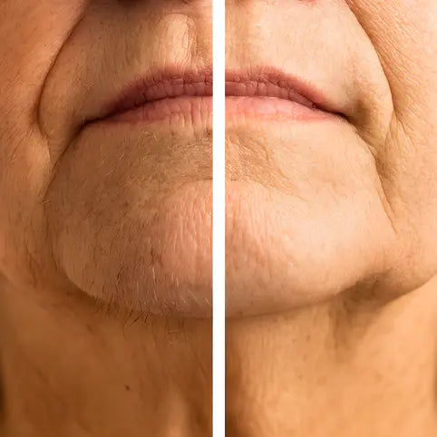 GlowTrim™ 2-in-1 Facial Hair Remover